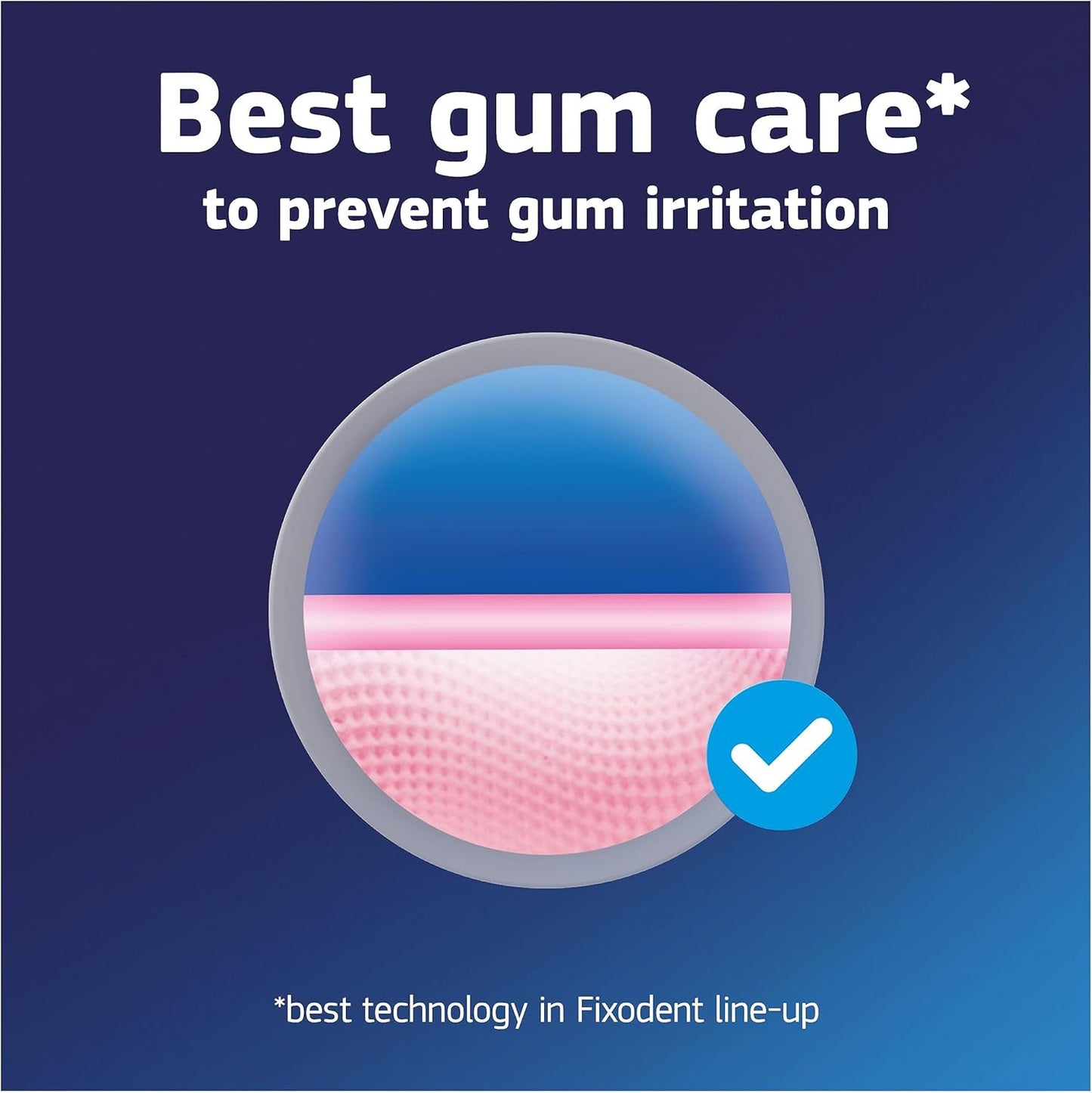 Professional Denture Adhesives Cream, 40 Ml, 'S Best Hold & Antibacterial Action, Precise Application with Super Thin Nozzle, Mint