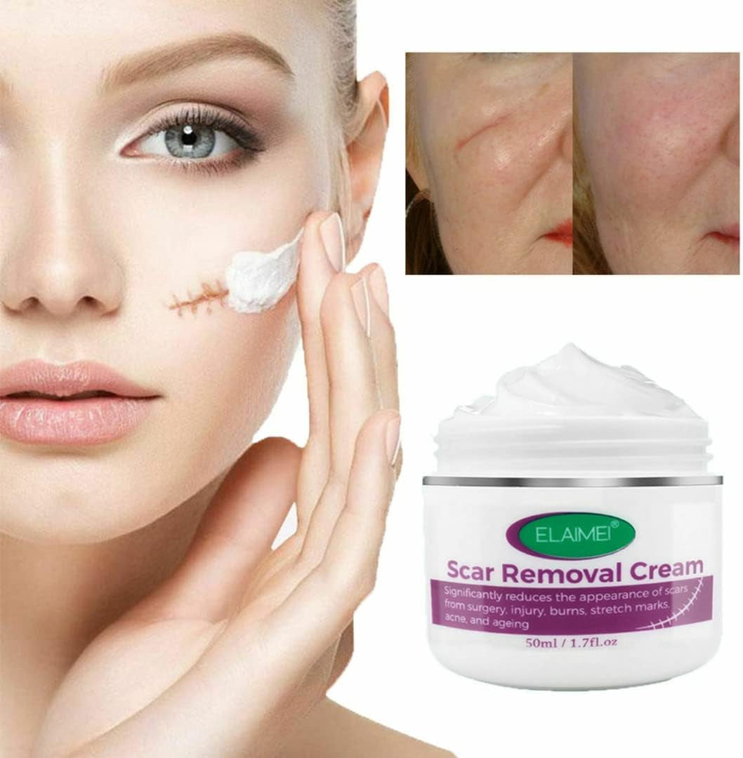 Scar Removal Cream New & Appearance of Old Scars Surgery, Stretch Marks, Acne, Burns & Injuries Face or Body, Working for Removing Scars and Strech Mark for Pregnancy