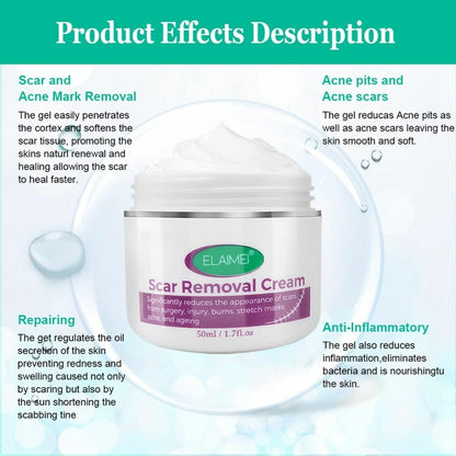 Scar Removal Cream New & Appearance of Old Scars Surgery, Stretch Marks, Acne, Burns & Injuries Face or Body, Working for Removing Scars and Strech Mark for Pregnancy